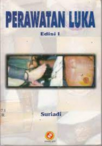 Perawatan luka