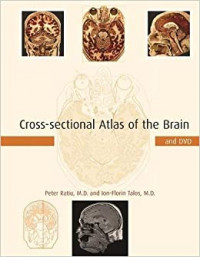 Cross-sectional atlas of the brain