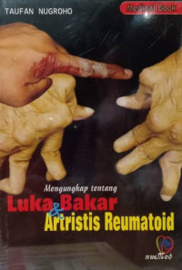 Mengungkap tentang luka bakar dan artristis reumatoid