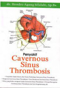 Penyakit cavernous sinus thrombosis