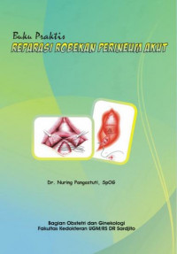 Buku praktis reparasi robekan perineum akut